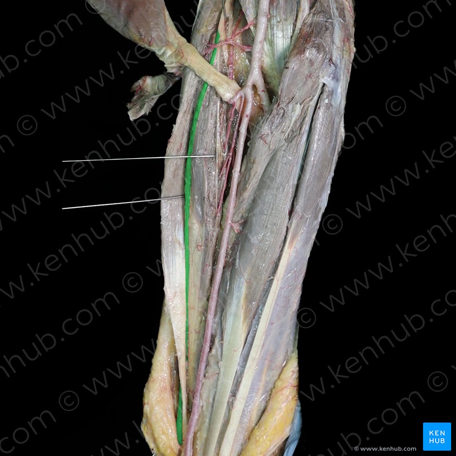Ramo superficial del nervio radial (Ramus superficialis nervi radialis); Imagen: 