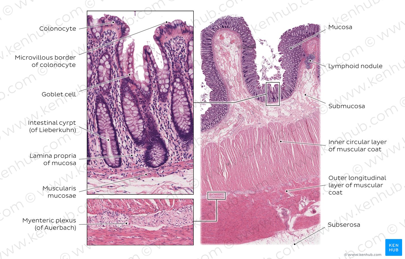 Longitudinal section of colon. Stain: H&E. Left boxes: High magnification, Right box: Low magnification.