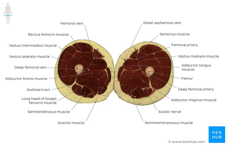 Cross sectional anatomy | Kenhub