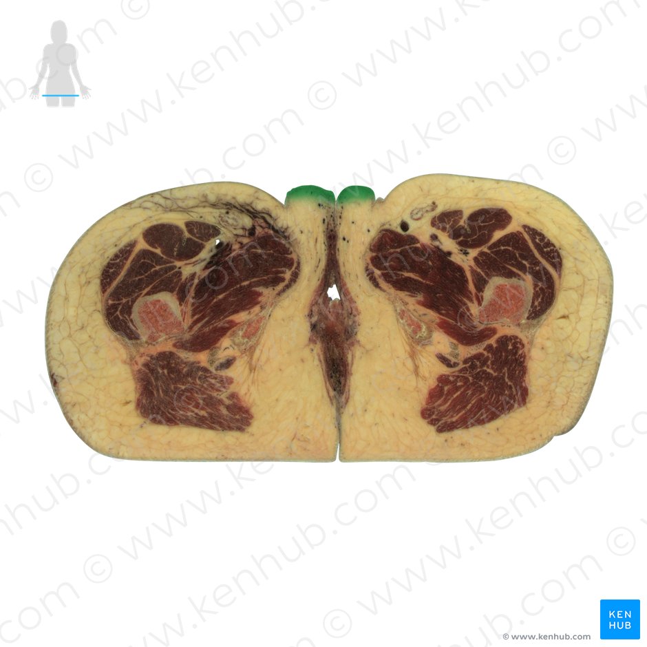 Labium majus of vulva (Labium majus vulvae); Image: National Library of Medicine
