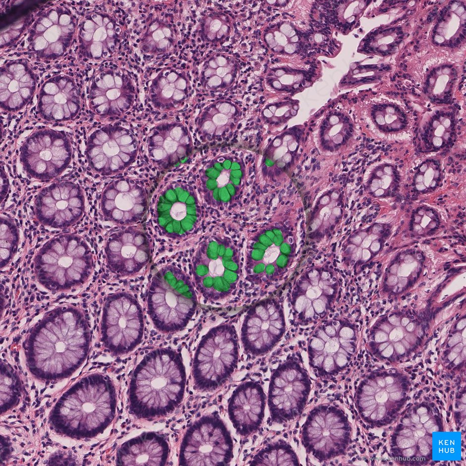Célula caliciforme (Exocrinocytus caliciformis); Imagen: 