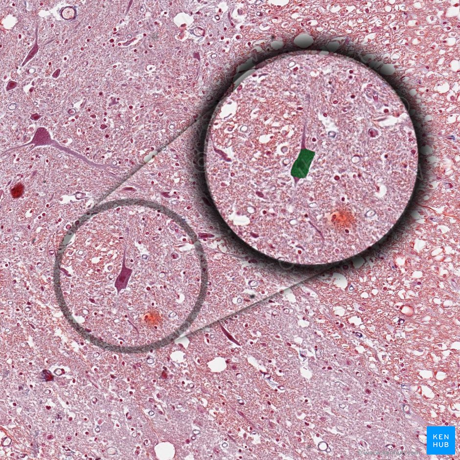 Cuerpo celular de la neurona (Soma); Imagen: 