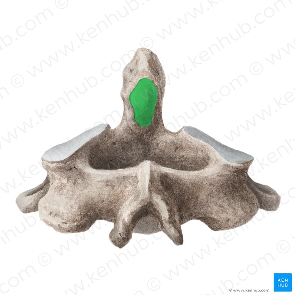 Carilla articular posterior del proceso odontoides (Facies articularis posterior dentis axis); Imagen: Liene Znotina
