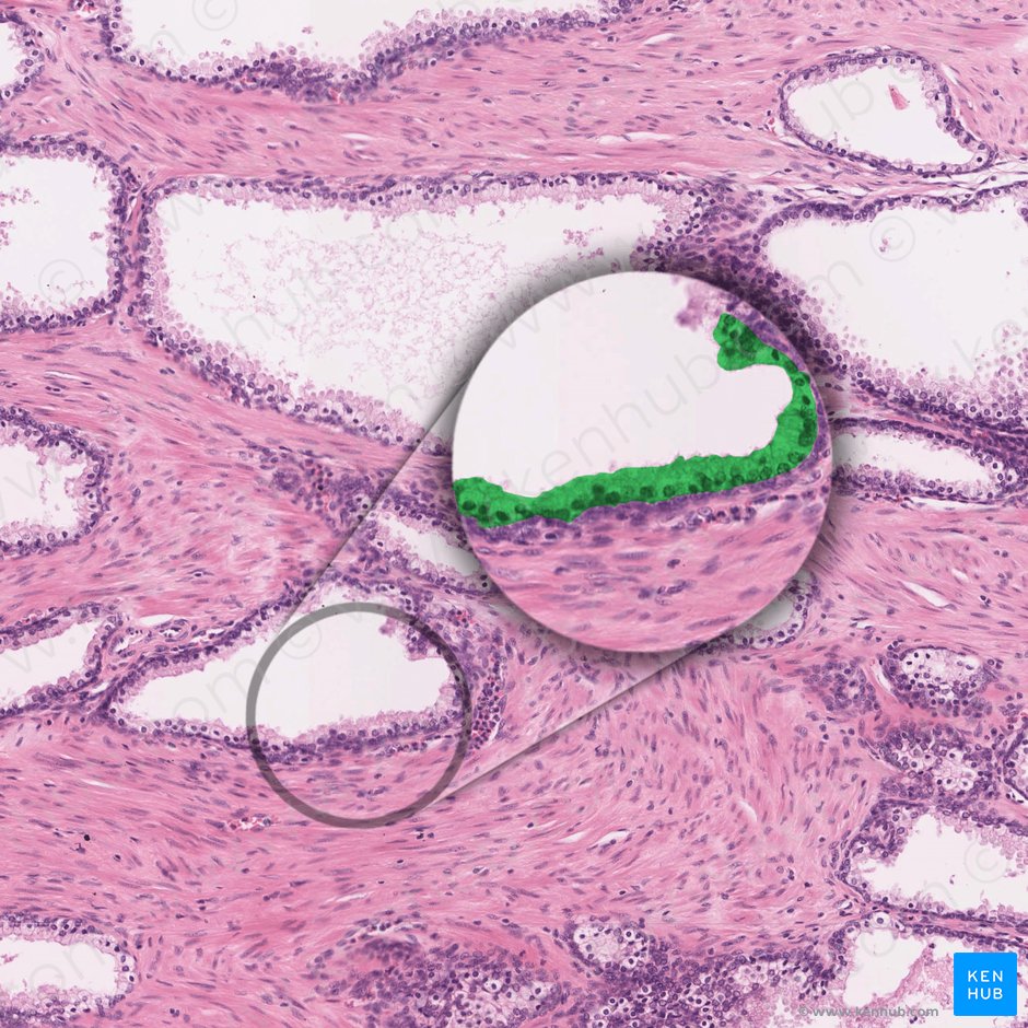 celulas de la prostata histologia