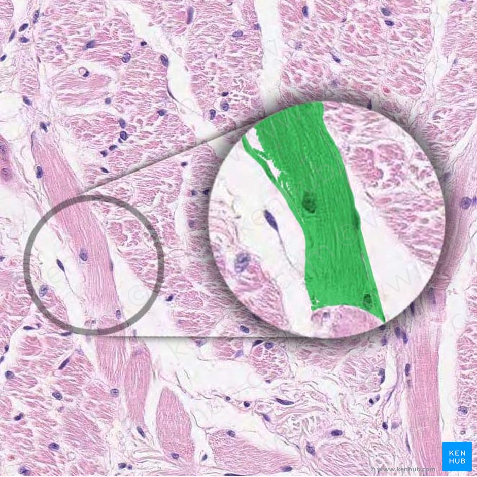 Miocito (fibra muscular) (Myocytus (Myofibra)); Imagen: 