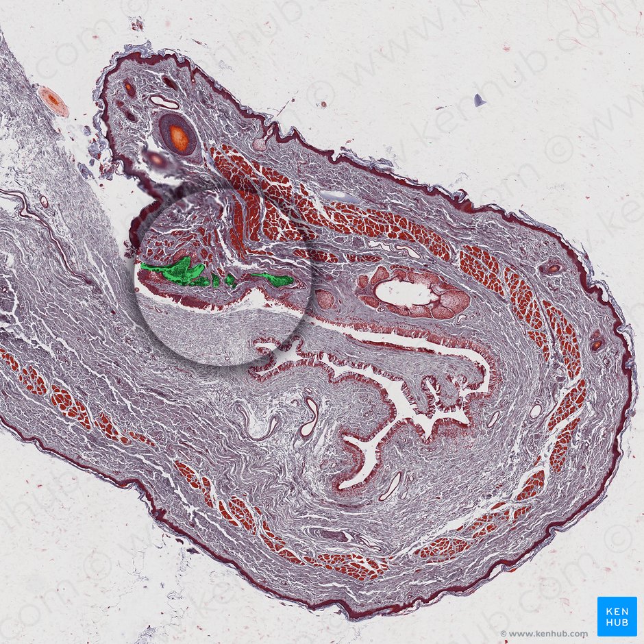 Glands of Moll; Image: 