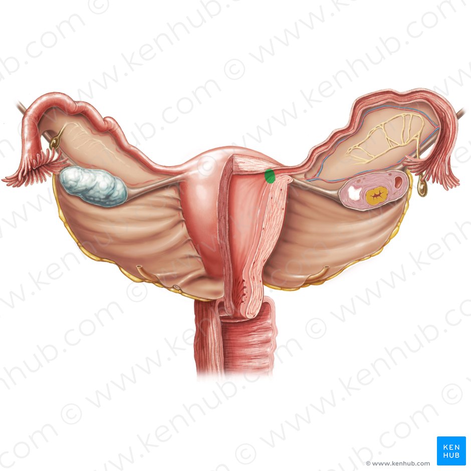Orificio uterino de la tuba uterina (Ostium uterinum tubae uterinae); Imagen: Samantha Zimmerman