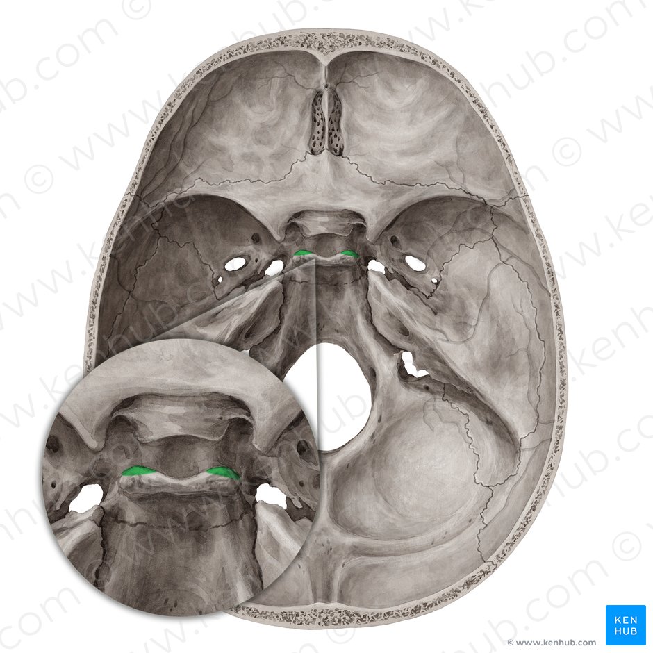 Processo clinoide posterior do osso esfenoide (Processus clinoideus posterior ossis sphenoidalis); Imagem: Yousun Koh