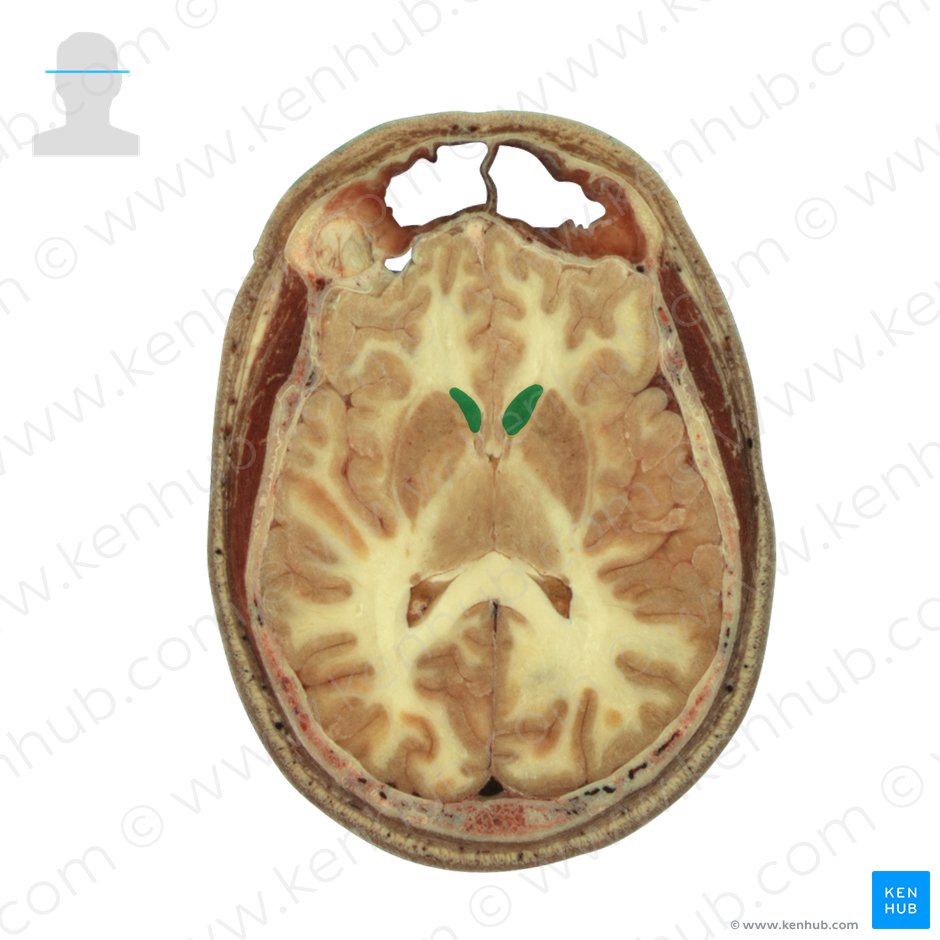 Head of caudate nucleus (Caput nuclei caudati); Image: National Library of Medicine