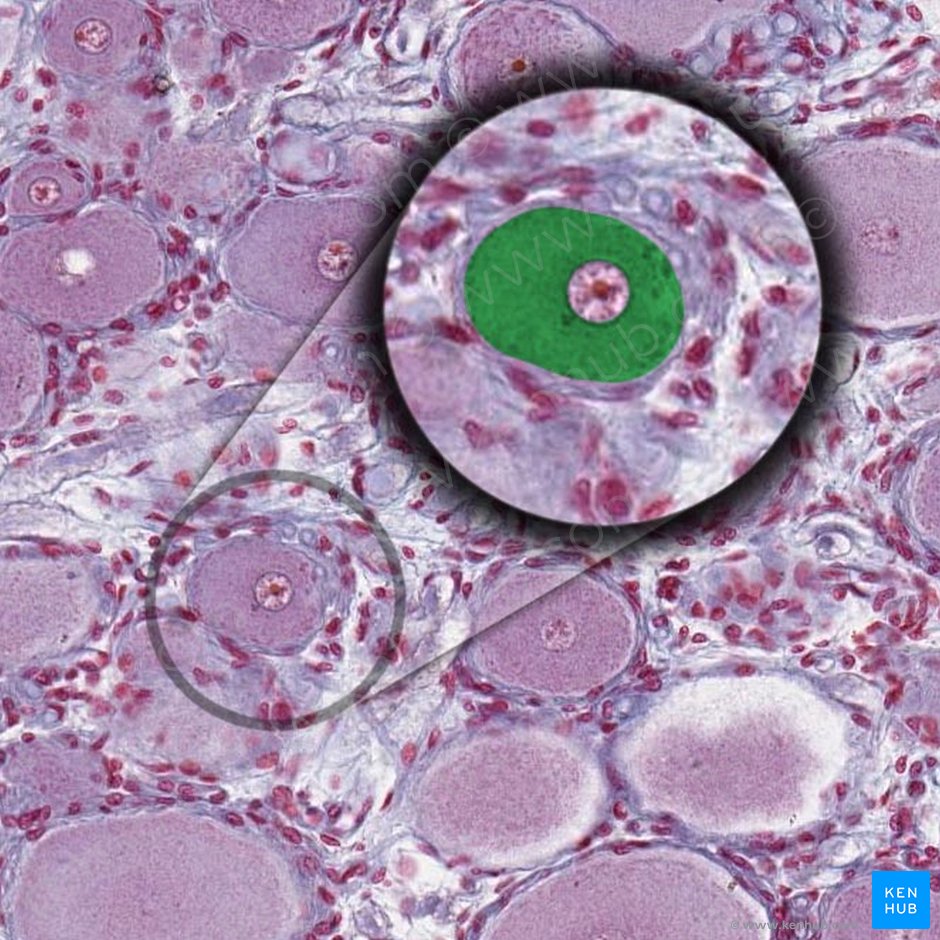 Cuerpo de célula ganglionar (Soma ganglii); Imagen: 