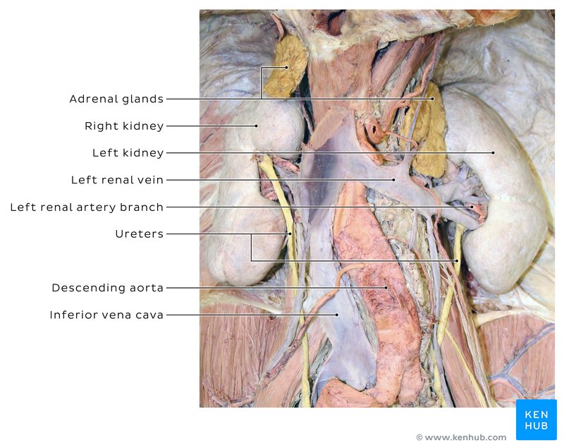 Horseshoe kidney transplantation: Anatomy and images | Kenhub