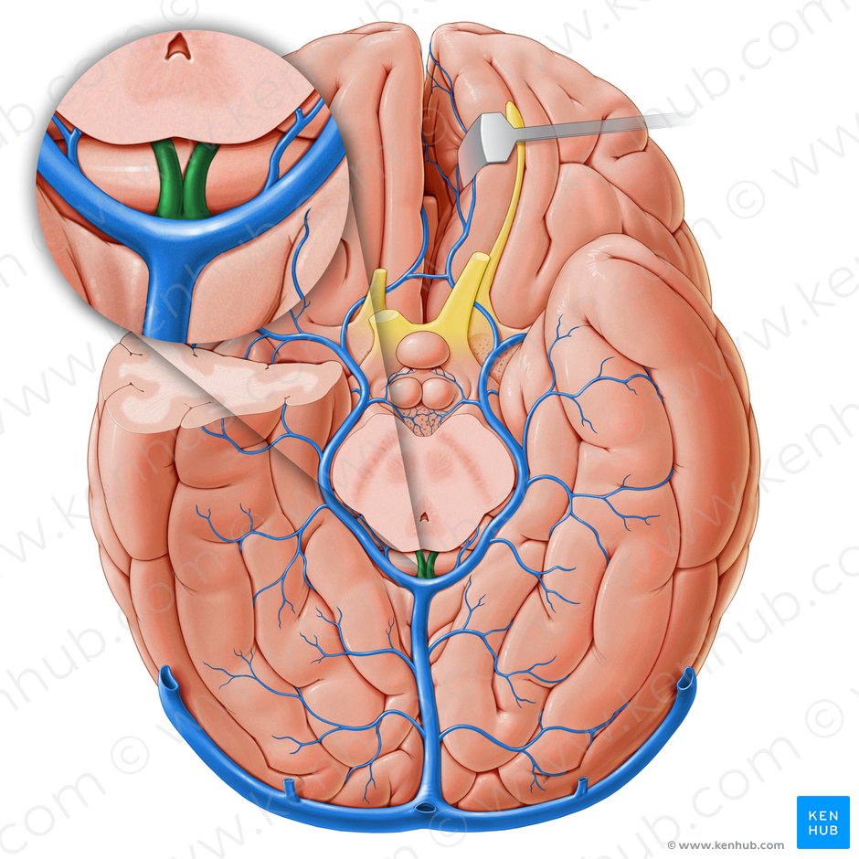 Internal cerebral veins (Venae internae cerebri); Image: Paul Kim