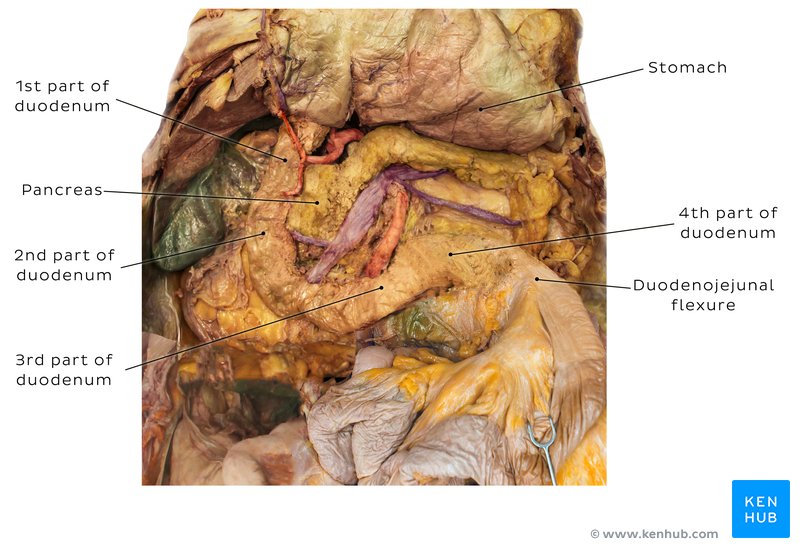 Duplication of duodenum: Clinical case and cadaver Images | Kenhub
