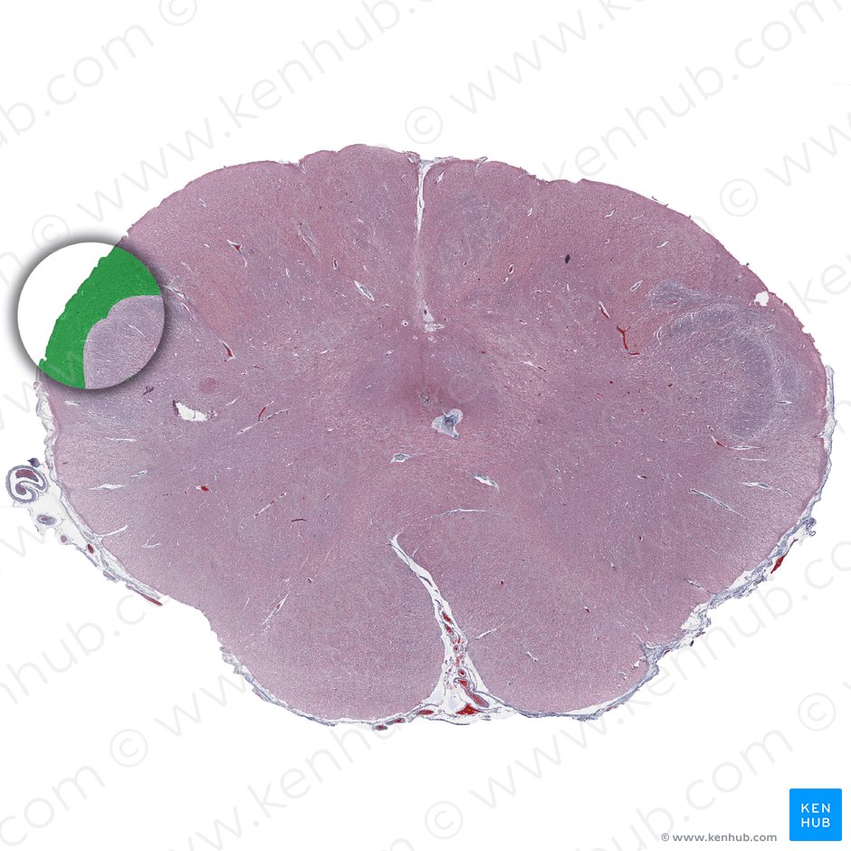 Spinal tract of trigeminal nerve (Tractus spinalis nervi trigemini); Image: 