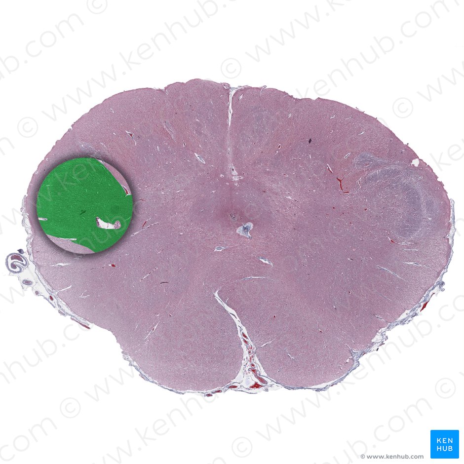 Spinal nucleus of trigeminal nerve (Nucleus spinalis nervi trigemini); Image: 