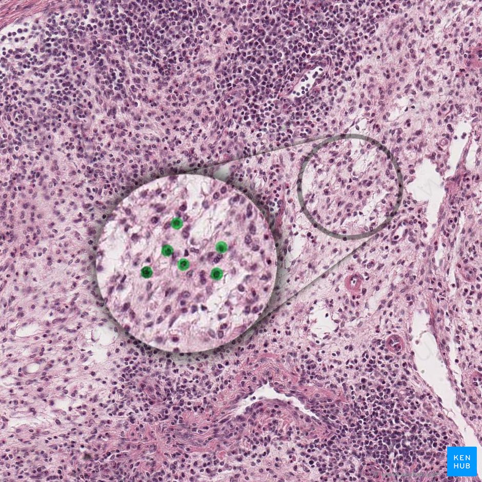 Reticular cells (Cellula reticularis); Image: 