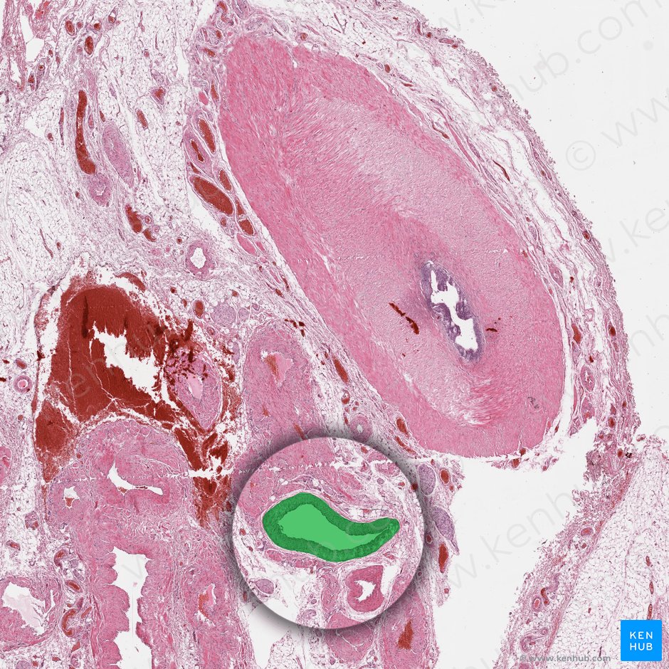 Arteria testicularis (Hodenarterie); Bild: 