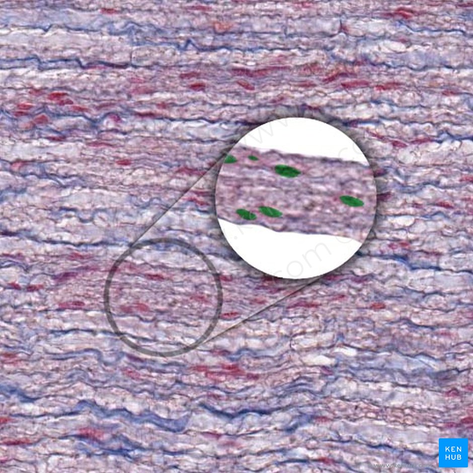 Núcleo de la célula de Schwann (Nucleus schwannocyti/fibroblasti endoneurialis); Imagen: 