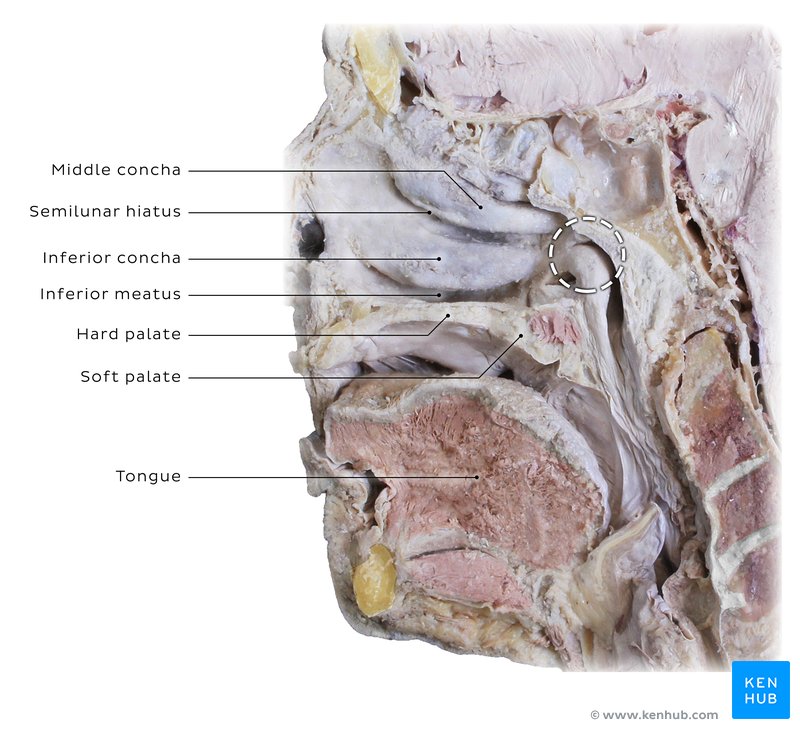 Schwannoma of the nasal cavity: Clinical case, diagnosis | Kenhub