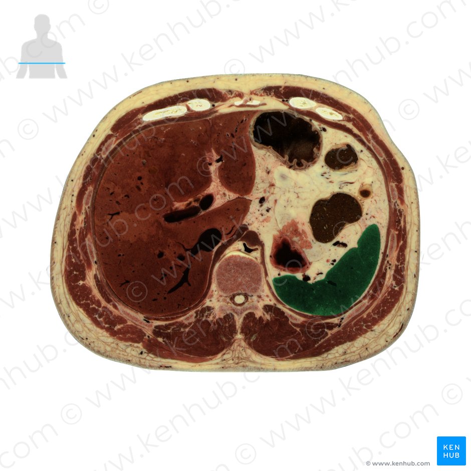 Spleen (Splen); Image: National Library of Medicine