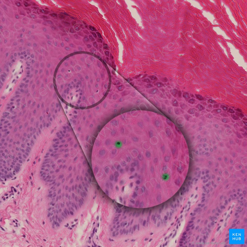 Langerhans cell (Cellula Langerhans); Image: 