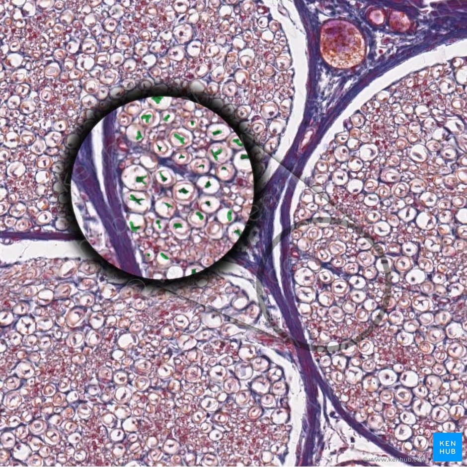 Axón periférico mielinizado (Axon myelinatum periphericum); Imagen: 
