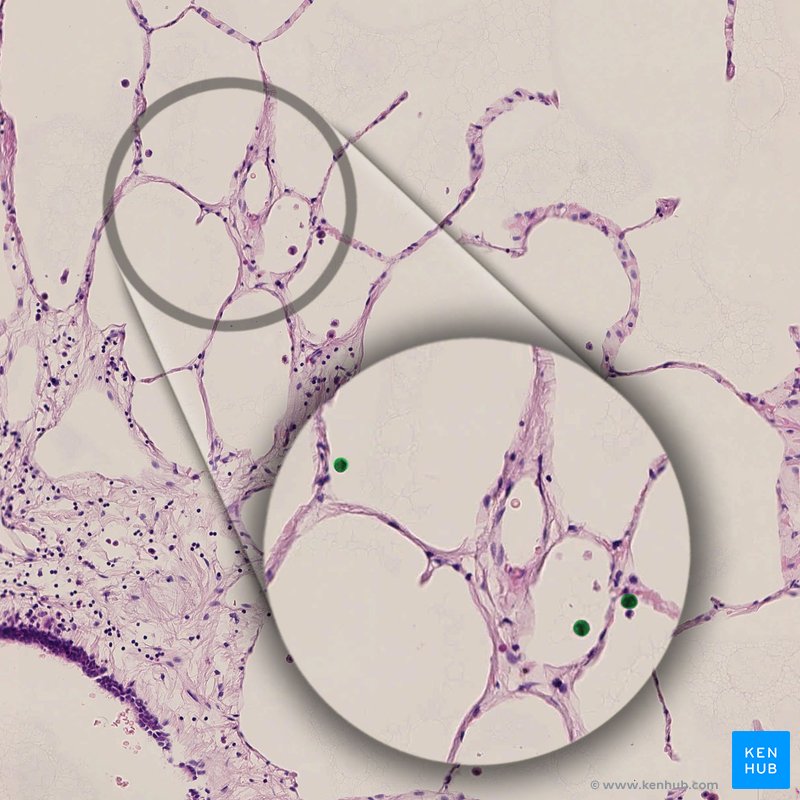 Alveolar macrophages - histological slide