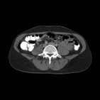 How to read an abdominal CT
