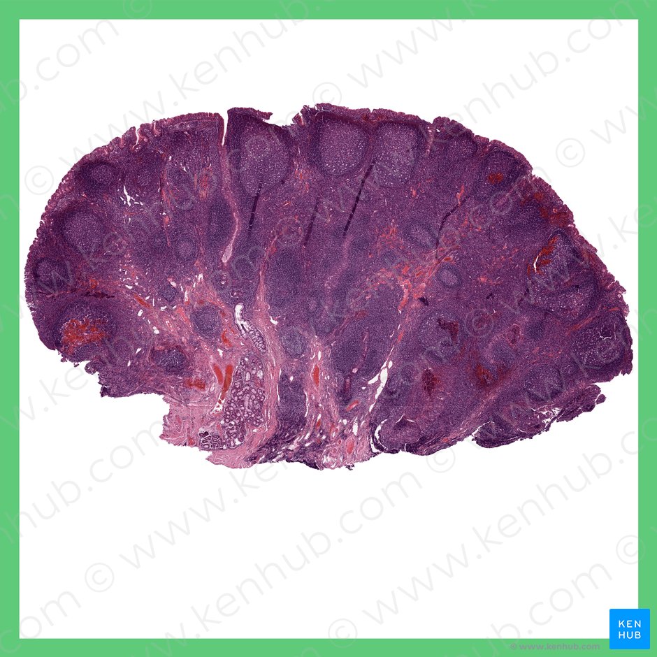 Pharyngeal tonsil (Tonsilla pharyngea); Image: 
