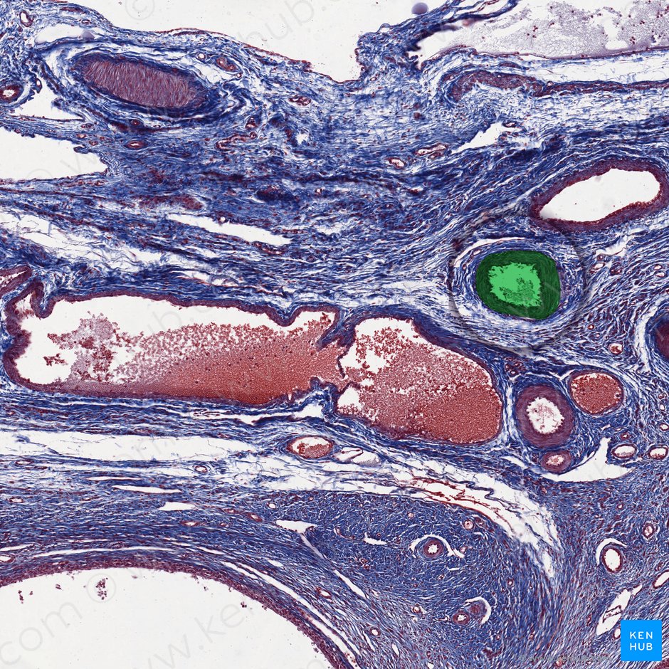 Arteria ovárica (Arteria ovarica); Imagen: 