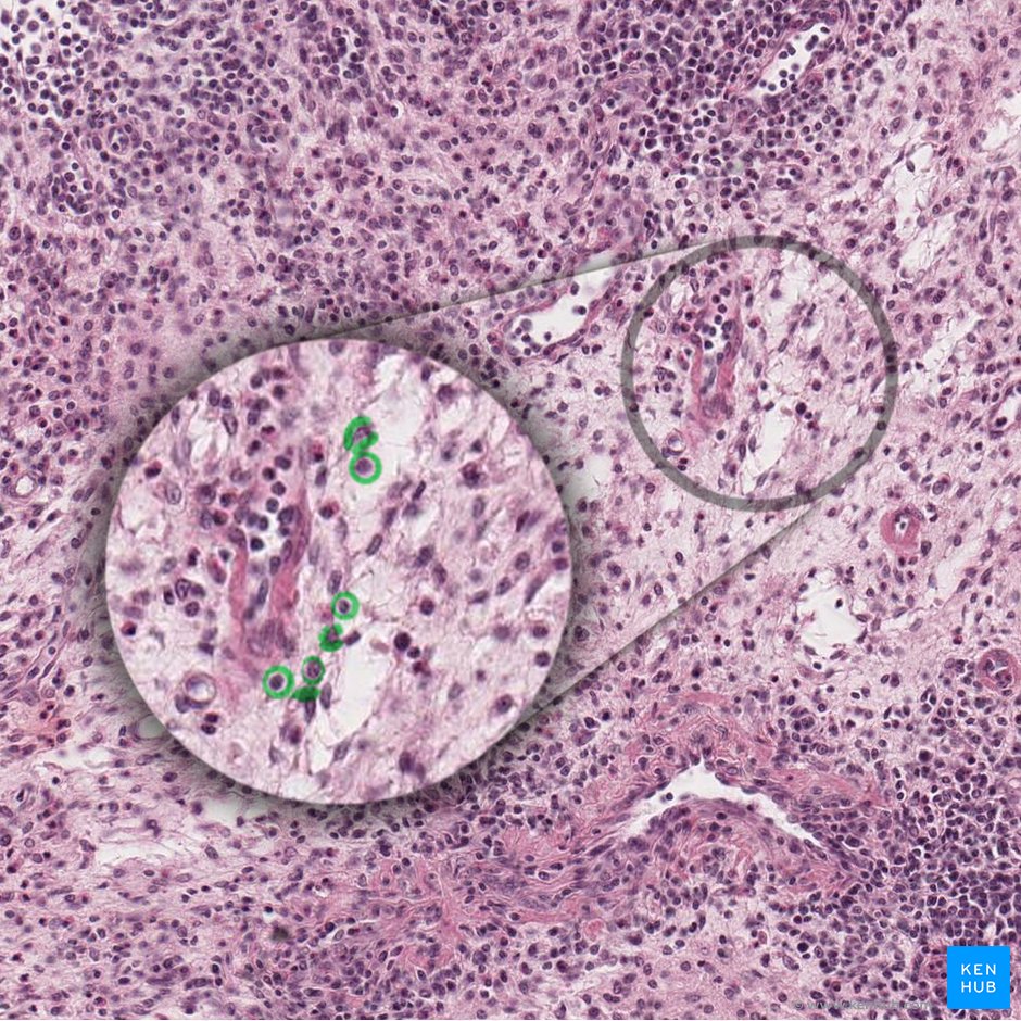 Zytoplasma der Retikulumzelle; Bild: 