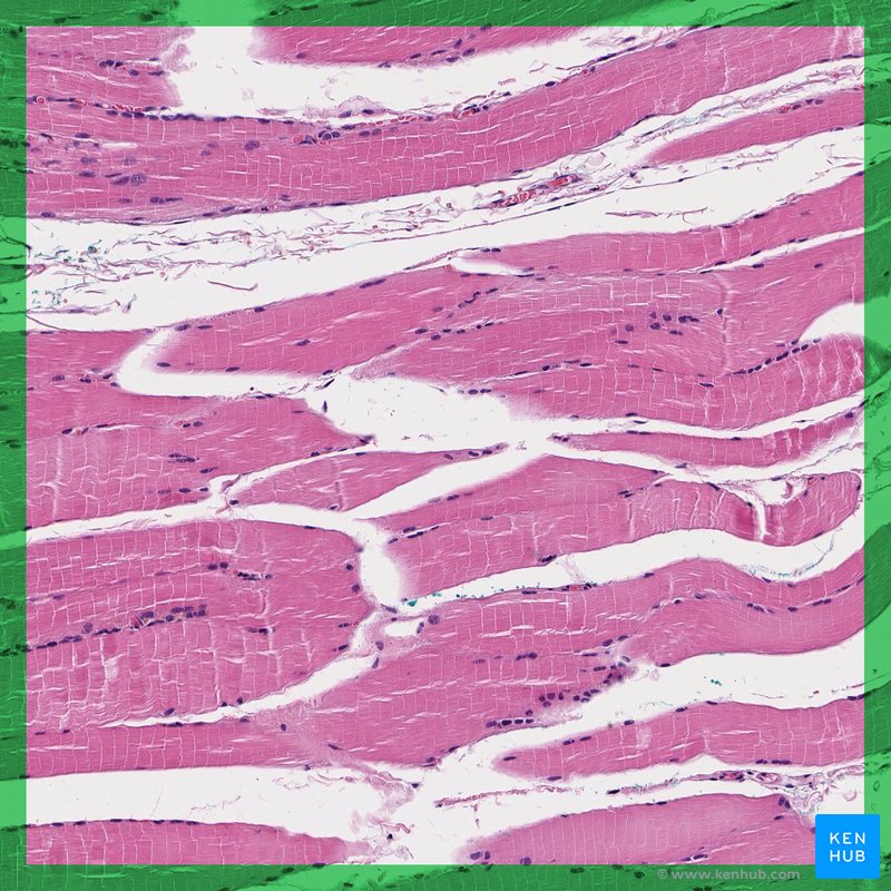 Skeletal muscle - histology slide