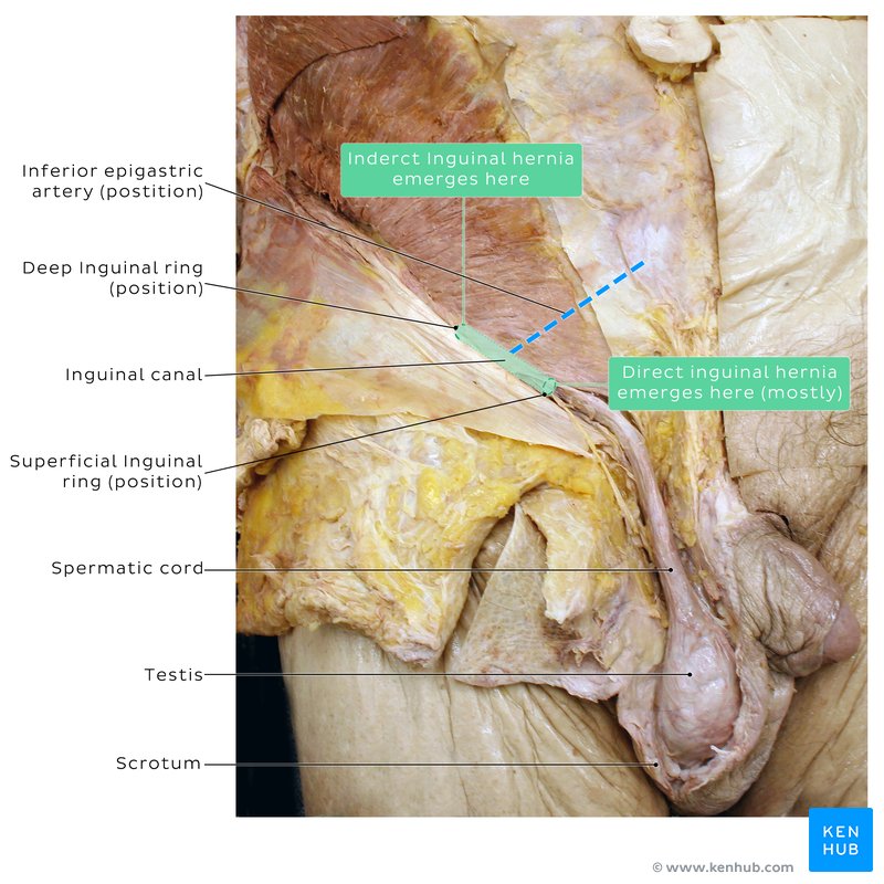 Spermatic cord - cadaveric dissection