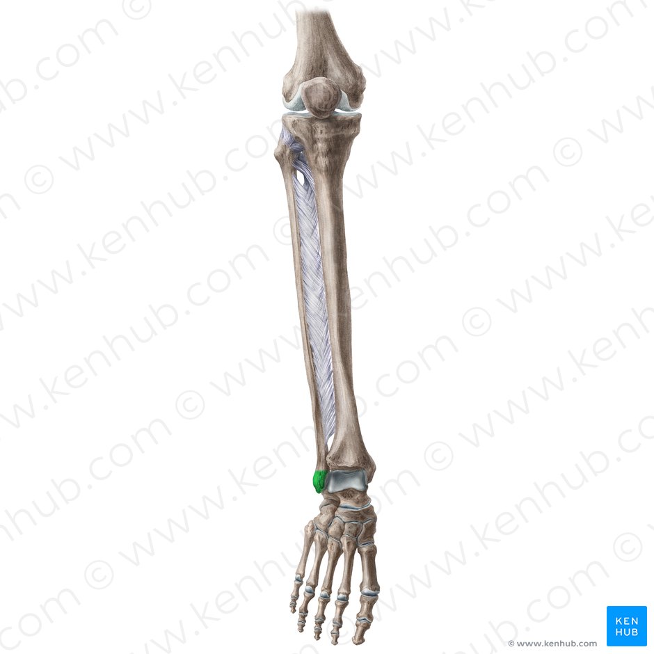 Maleolo lateral de la fíbula (Malleolus lateralis fibulae); Imagen: Liene Znotina