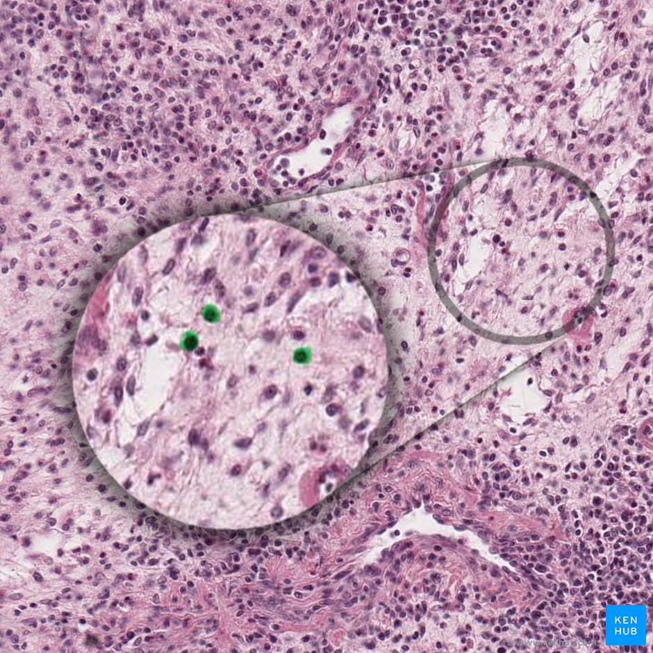 Lymphocytes (Lymphcyti); Image: 