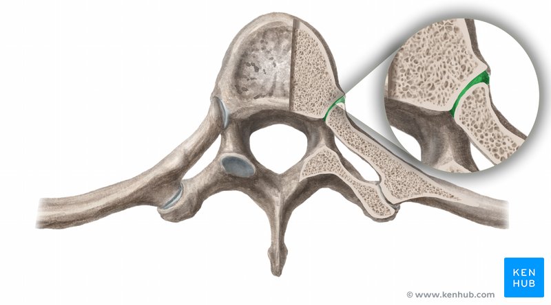 Osteoartrita costovertebrale simptome articulare, tratament