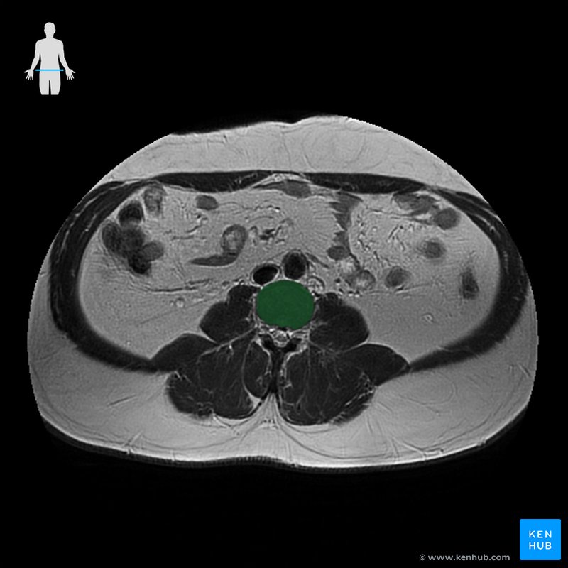 Radiological image (Vertebral body L3)