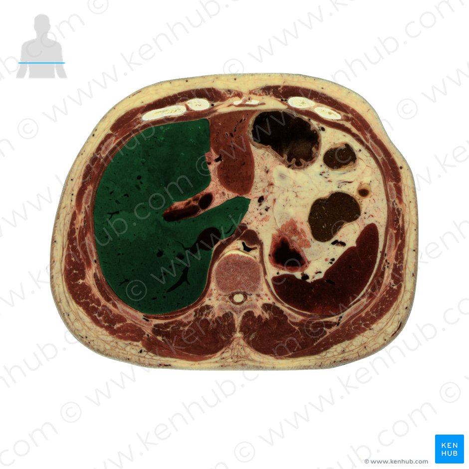 Right lobe of liver (Lobus dexter hepatis); Image: National Library of Medicine