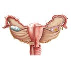 Uterus, Eileiter und Ovarien  