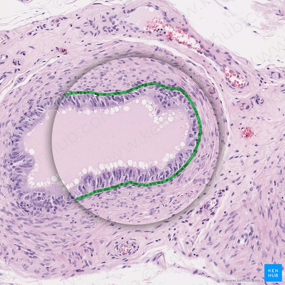 Miofibroblastos (Myofibroblasti); Imagen: 