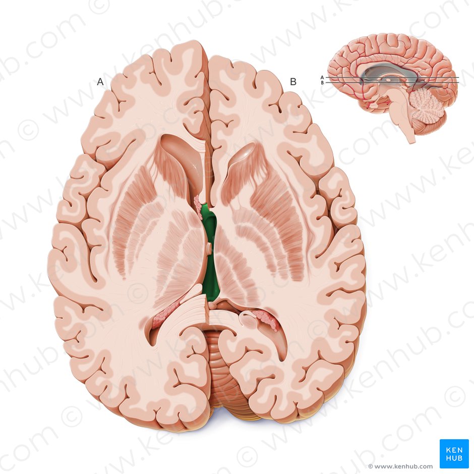Third ventricle (Ventriculus tertius); Image: Paul Kim