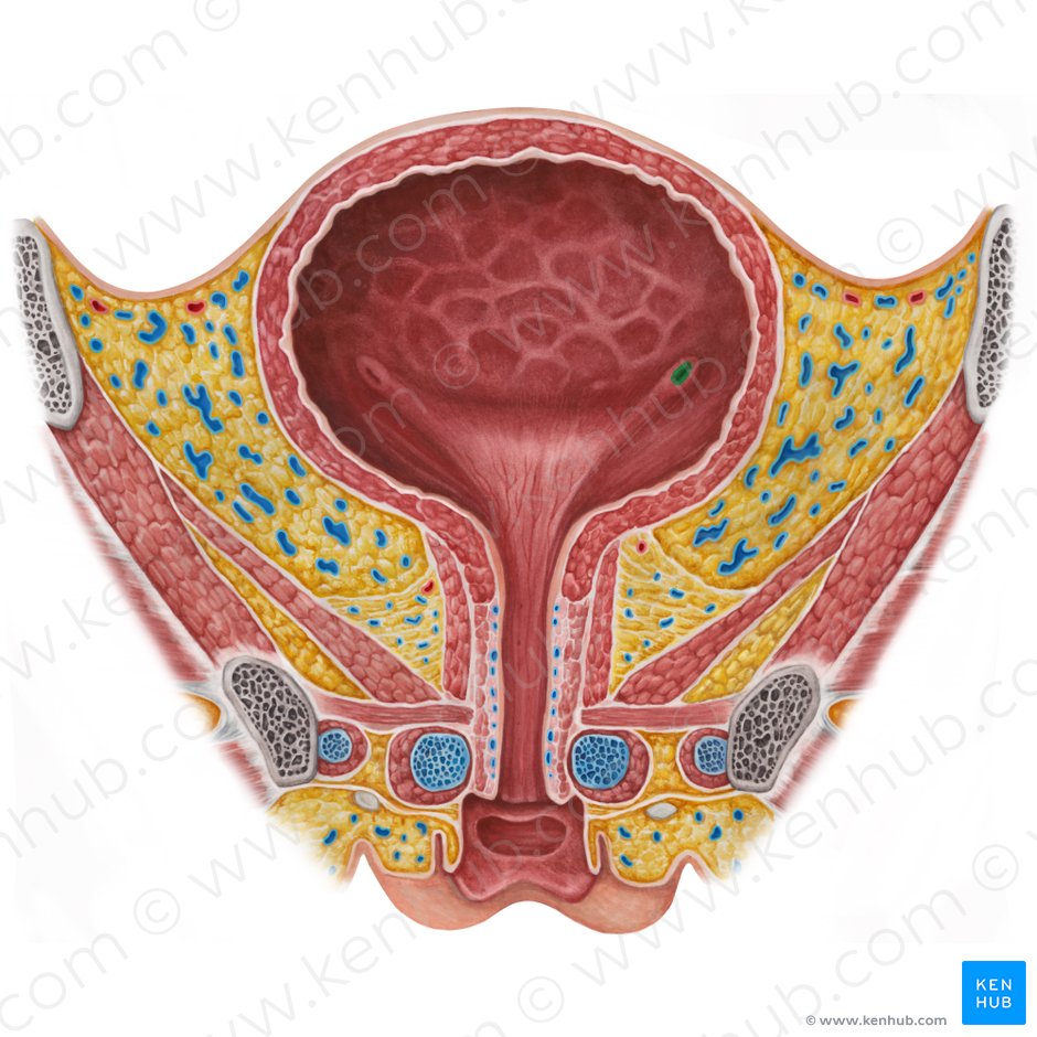 Orificio ureteral izquierdo (Ostium ureteris sinistrum); Imagen: Irina Münstermann