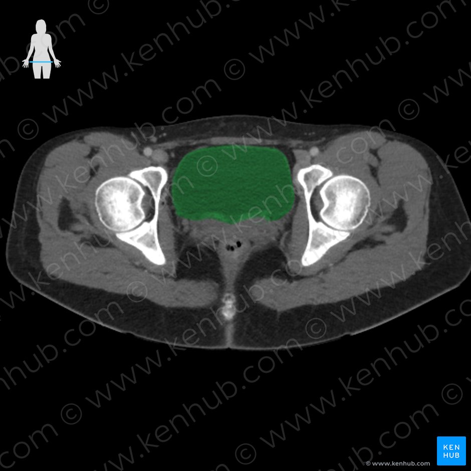 Urinary bladder (Vesica urinaria); Image: 