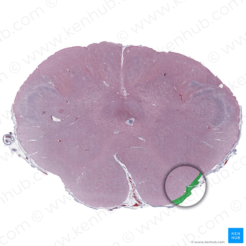 Arcuate nucleus of medulla oblongata (Nucleus arcuatus medullae oblongatae); Image: 