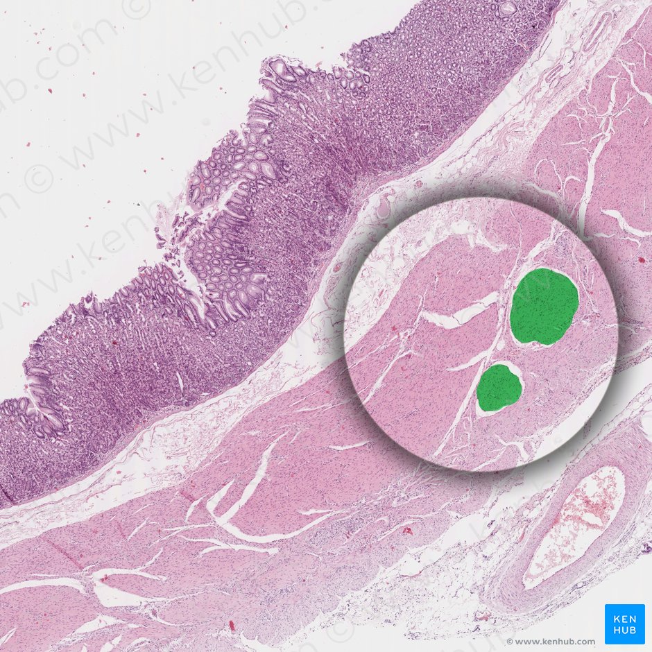 Circular layer of muscular coat of stomach (Stratum circulare tunicae muscularis gastris); Image: 