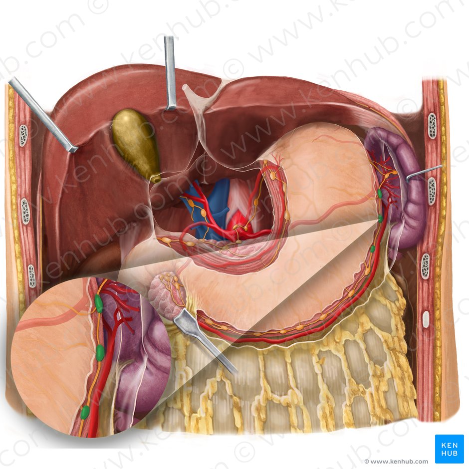 Ganglios linfáticos gastro-omentales izquierdos (Nodi lymphoidei gastroomentales sinistri); Imagen: Begoña Rodriguez