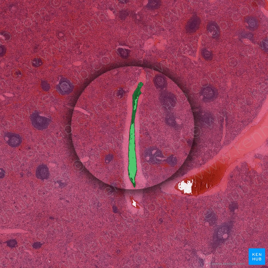 Trabecular vein of spleen (Vena trabecularis splenis); Image: 