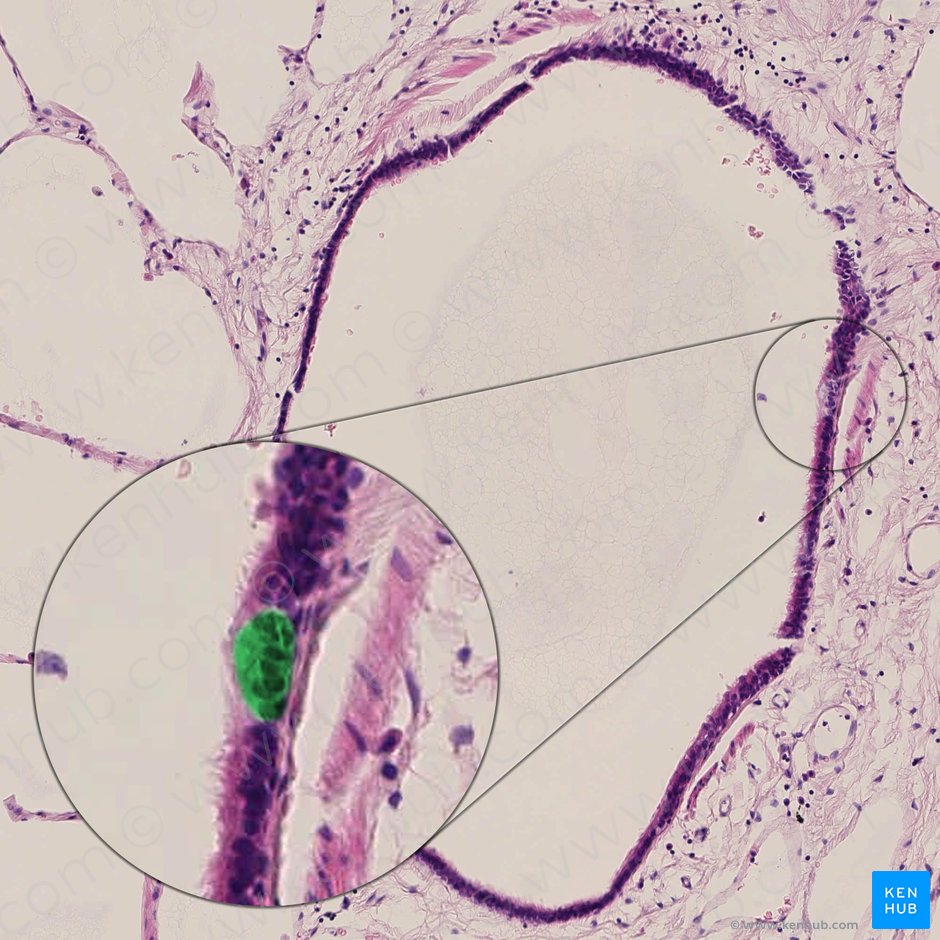 Exocrinocytus bronchiolaris (Keulenzellen); Bild: 