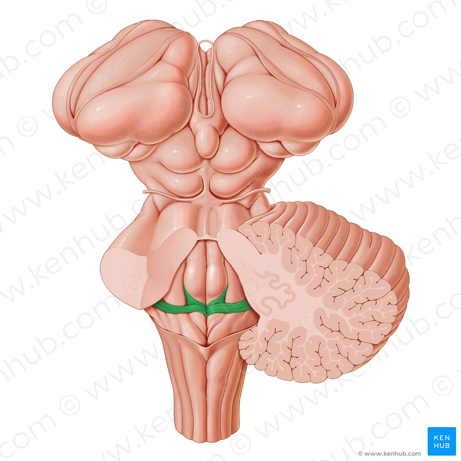 Medullary striae of fourth ventricle (Striae medullares ventriculi quarti); Image: Paul Kim