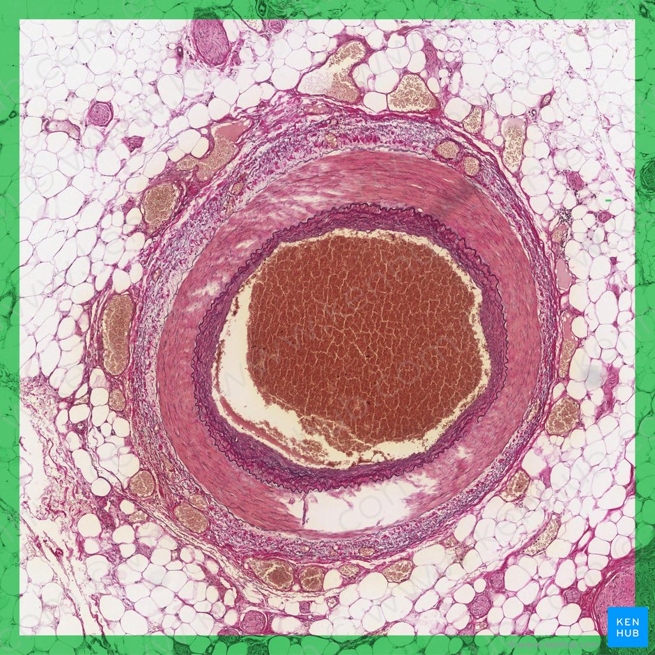 Artéria muscular (Arteria myotypica); Imagem: 